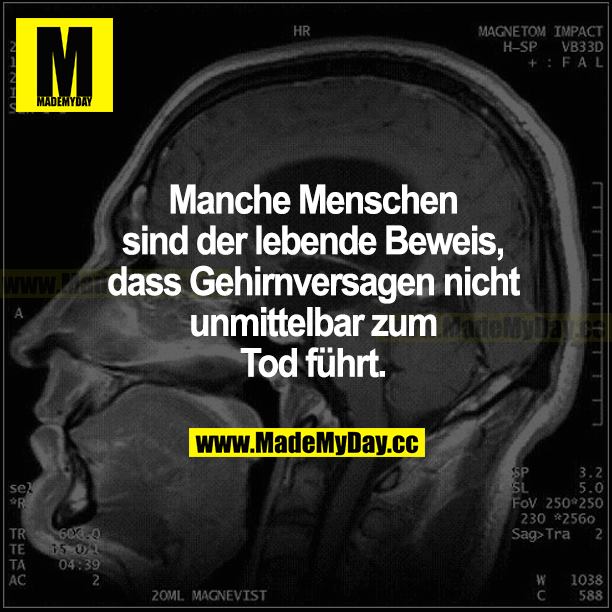 Manche Menschen sind der lebende Beweis, dass Gehirnversagen nicht unmittelbar zum Tod führt.