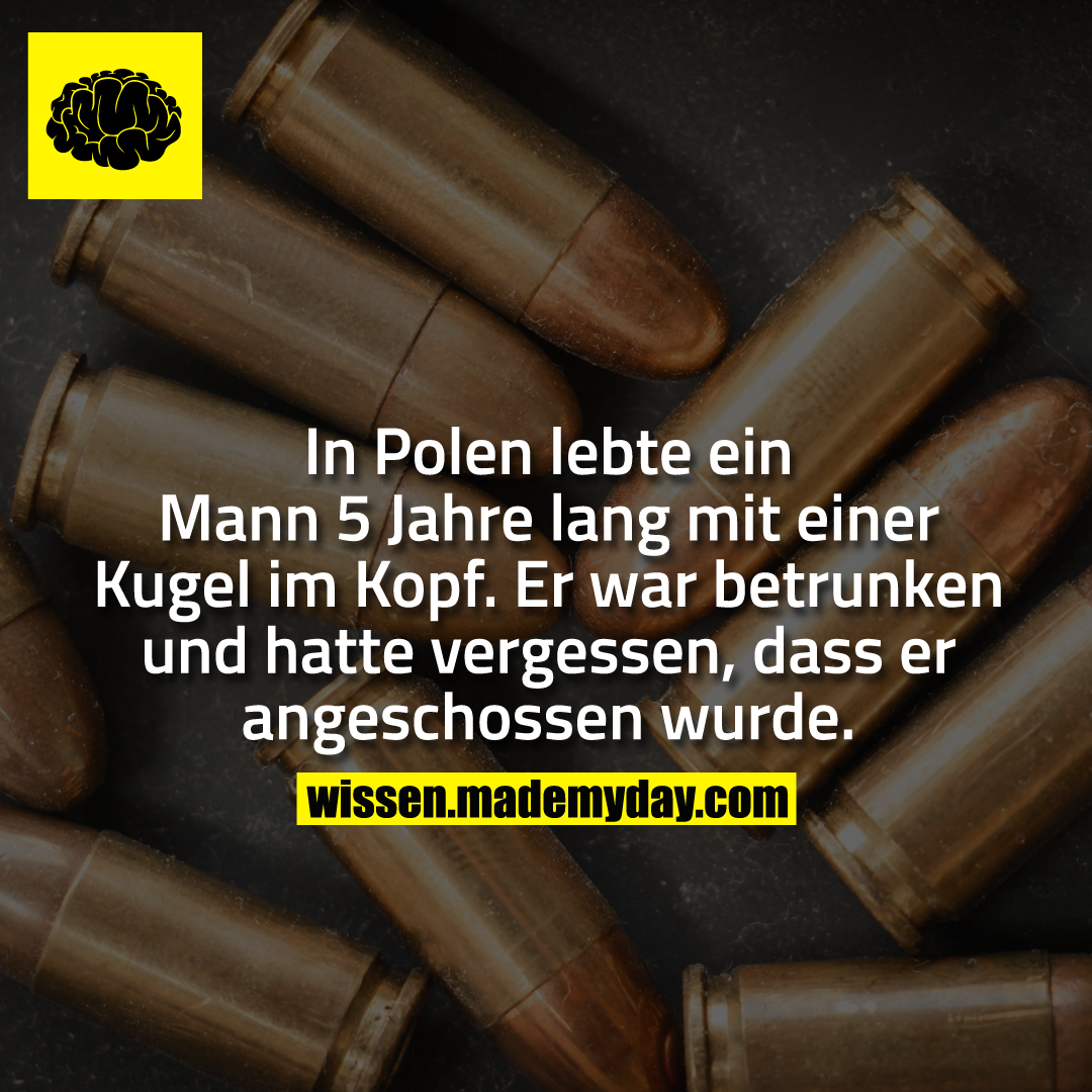 In Polen lebte ein Mann 5 Jahre lang mit einer Kugel im Kopf. Er war betrunken und hatte vergessen, dass er angeschossen wurde.