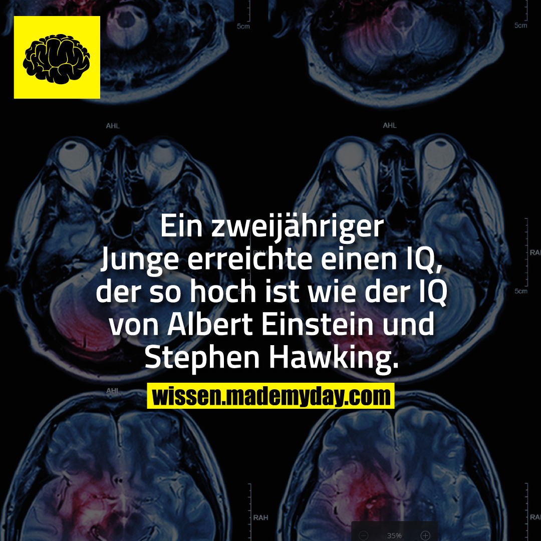 Ein zweijähriger Junge erreichte einen IQ, der so hoch ist wie der IQ von Albert Einstein und Stephen Hawking.