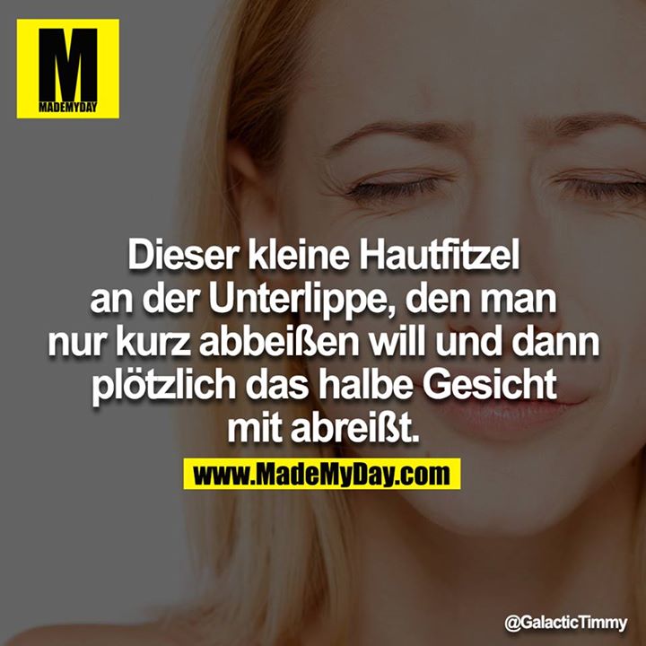 Dieser kleine Hautfitzel an der Unterlippe, den man nur kurz abbeißen will und dann plötzlich das halbe Gesicht mit abreißt.