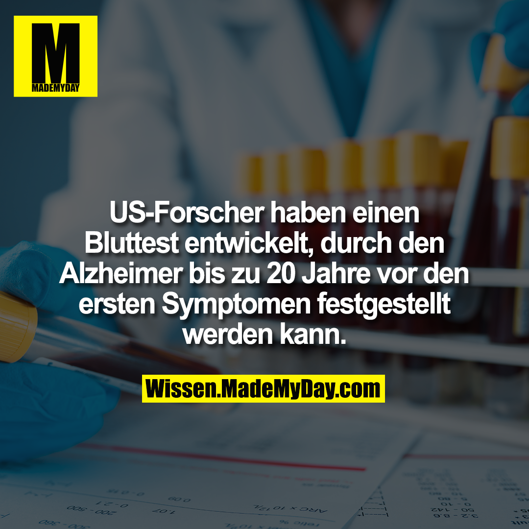 US-Forscher haben einen Bluttest entwickelt, durch den Alzheimer bis zu 20 Jahre vor den ersten Symptomen festgestellt werden kann.