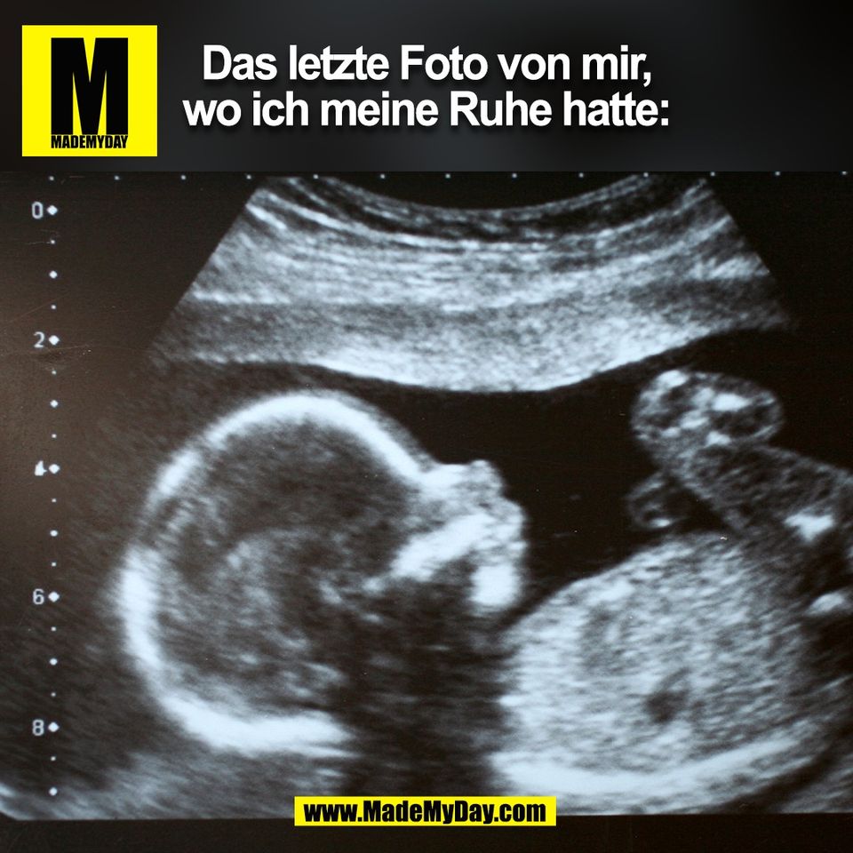 Das letzte Foto von mir,<br />
wo ich meine Ruhe hatte:<br />
(BILD)
