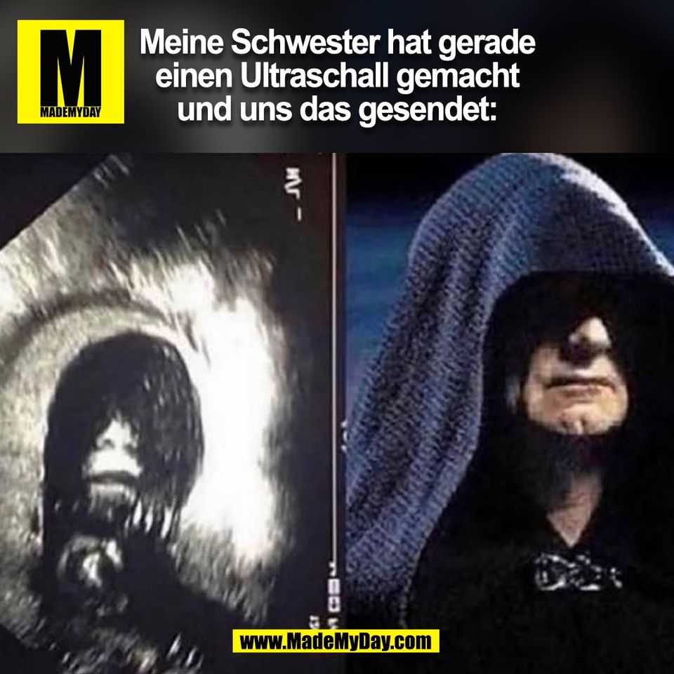 Meine Schwester hat gerade<br />
einen Ultraschall gemacht<br />
und uns das gesendet:<br />
(BILD)