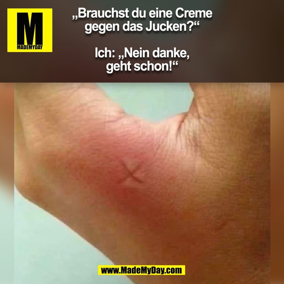 „Brauchst du eine Creme<br />
gegen das Jucken?“<br />
<br />
Ich: „Nein danke,<br />
geht schon!“<br />
(BILD)